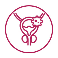 Urinary Bladder Cancer